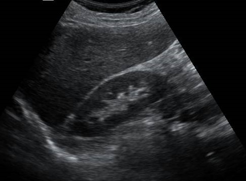 Normal liver image